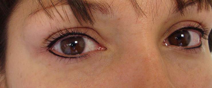 Semi permanent lash line enhancement