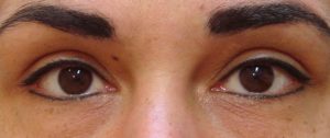 Semi Permanent Eyeliner Haywards Heath & West Sussex