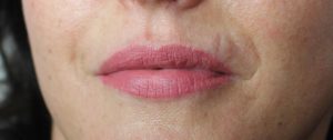 Luscious Semi Permanent Lips Haywards Heath & West Sussex