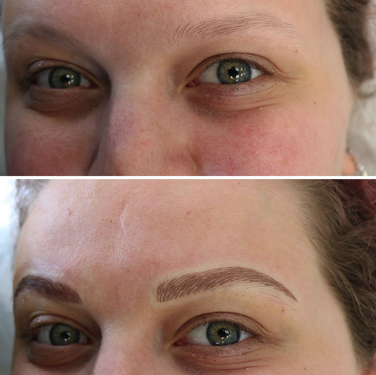 Microblading